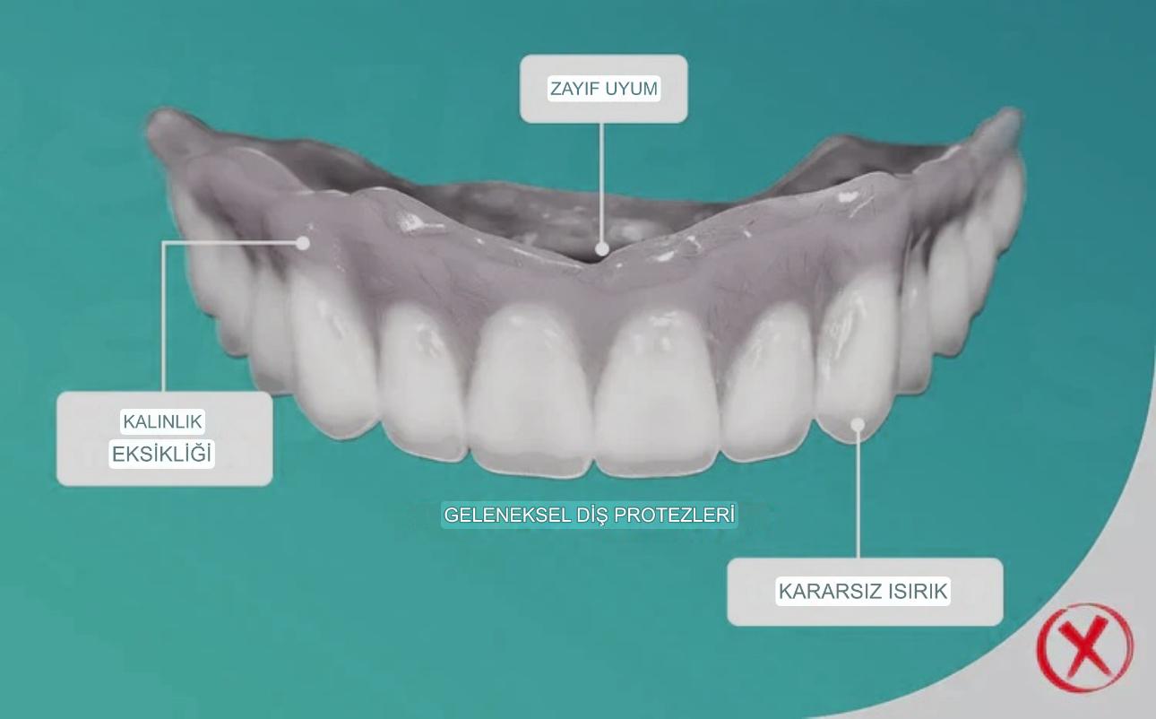 Denture Pluss™ 🦷Gelişmiş Kişiye Özel Tam Protez Seti🦷