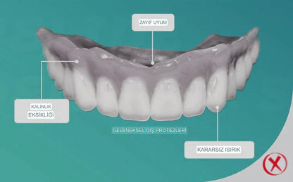 Denture Pluss™ 🦷Gelişmiş Kişiye Özel Tam Protez Seti🦷